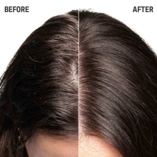 Шампунь для зміцнення тонкого волосся Dualsenses Scalp Specialist Goldwell 250 мл